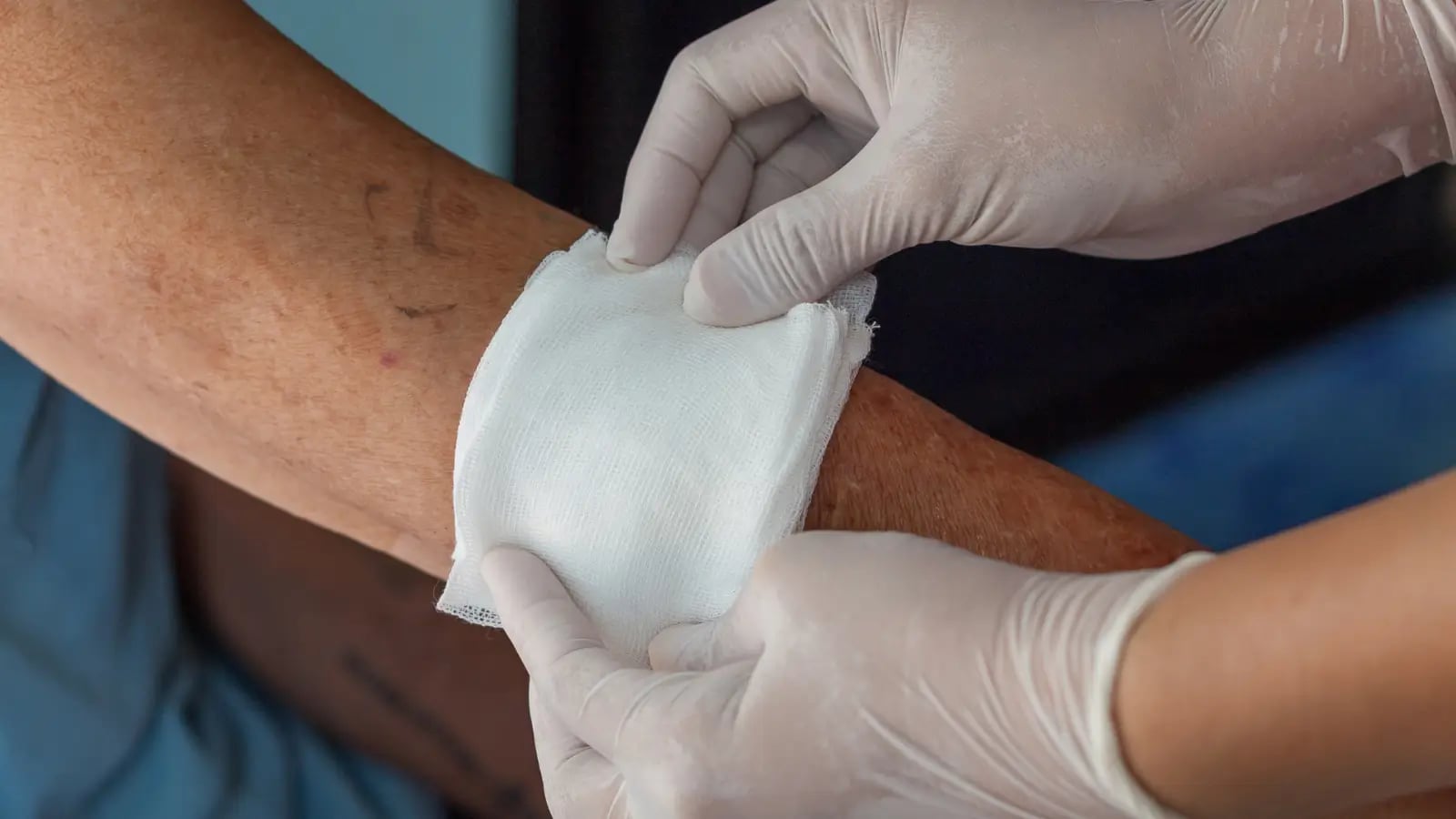<span></span><span></span><span></span><span style="white-space: pre-wrap;">Burn injuries</span>